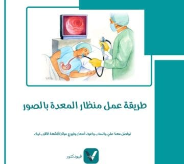 طريقة عمل منظار المعدة