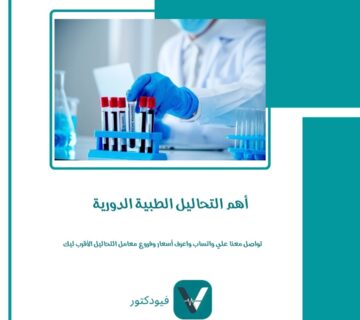 أهم التحاليل الطبية الدورية