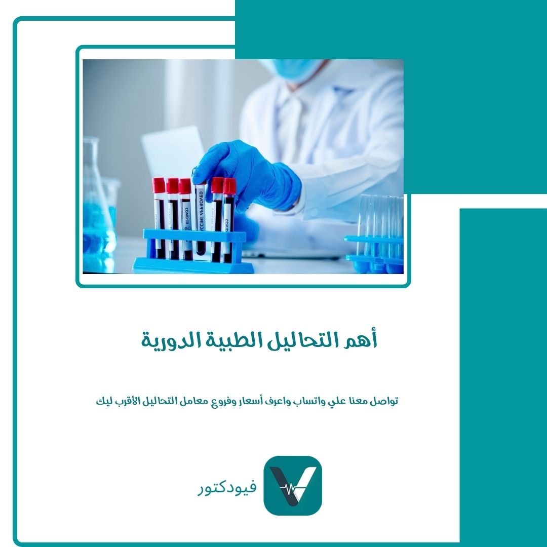 أهم 10 التحاليل الطبية الدورية للاطمئنان على صحتك 1 أهم التحاليل الطبية الدورية